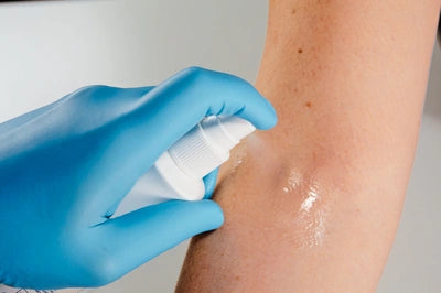 Desinfektionsspray auf Haut anwenden – medizinische Pflege mit Einmalhandschuh